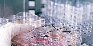 Vaiolo delle scimmie, primo caso in Australia