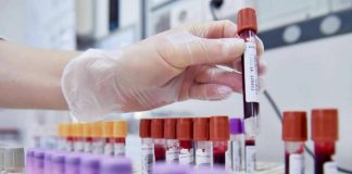 Beta-talassemia grave colpisce 5mila italiani, 8 maggio Giornata mondiale