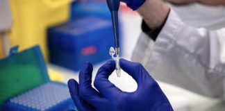 Epatite acuta bambini, Palù: “Causa più probabile adenovirus umano F41”