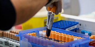 Covid oggi Fvg, 443 contagi e un morto: bollettino 8 maggio