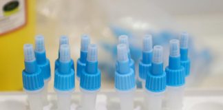 Omicron 5, Gismondo: “E’ come un’influenza”