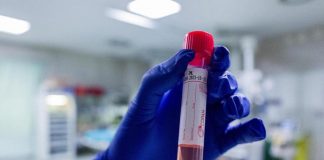 Covid oggi Calabria, 3.537 contagi e 1 morto: bollettino 5 luglio