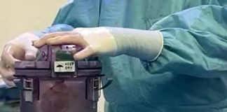 Trapianti, al Bambino Gesù cuore trasportato a temperatura controllata