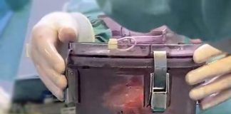 Cuore trasportato con sistema innovativo salva la vita a un bimbo