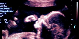 La fertilità è servita, regole di nutrizione per chi cerca un figlio