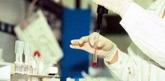 Sclerosi multipla, terapia orale efficace fin dalle fasi precoci malattia