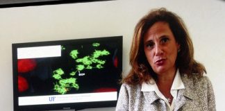 Vaiolo delle scimmie, Capua: “Diffusione inattesa e preoccupante”