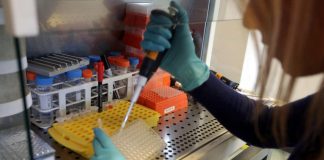 Sla, studio italiano spiega uno dei meccanismi che la causa