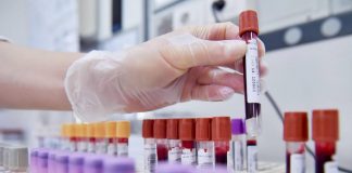 Leucemia, dalla svolta imatinib al sogno della cura senza chemio