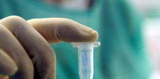 Virus Marburg, cos’è e sintomi: perché se ne riparla