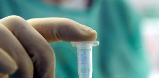 Vaiolo delle scimmie, secondo caso in Liguria
