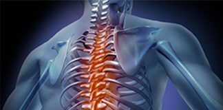 Spondilite anchilosante, ok Aifa al rimborso del primo Jaki orale