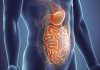 Malattia di Crohn, primo ok Ema per inibitore di Il-23