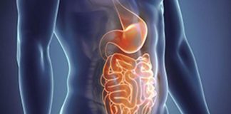 Malattia di Crohn, primo ok Ema per inibitore di Il-23