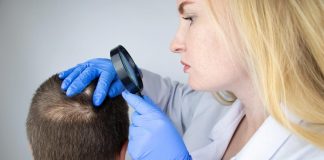 Alopecia areata, 1,2 mln italiani con perdita peli e capelli: c’è la terapia