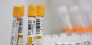 Covid oggi Abruzzo, 1.036 contagi e un morto: bollettino 28 settembre