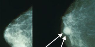 Il 20 settembre al Mamu convegno Ats e ASST sullo studio dei cancri