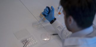 Osteoporosi, anticorpo monoclonale migliora parametri ossei