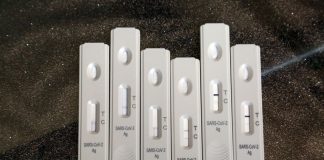 Covid, Sono 15.089 i nuovi positivi. 51 i decessi