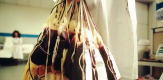 Bms, terapia contro mielodisplasie libera il 48% dei pazienti dalle trasfusione per 8 settimane