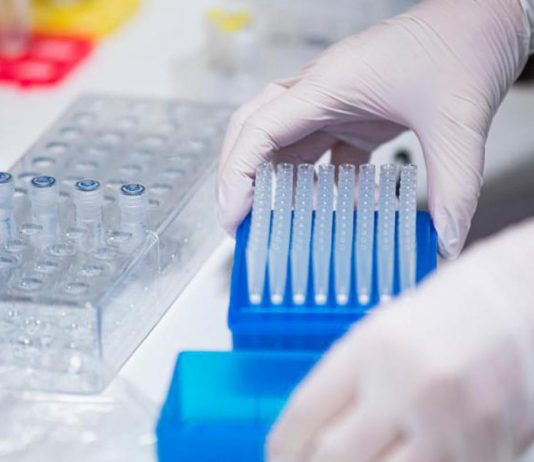 Malattie rare, pazienti con Dravet: “Non tutti rispondono a nuove cure”