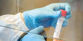 Covid, Oms: in Italia +59% contagi in una settimana