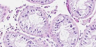 Tumori, Mantovani: “Dati incoraggianti da vaccini a mRna”