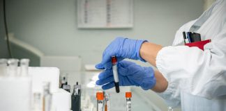 Covid, Cnr: nuovo test del sangue misura anticorpi neutralizzanti