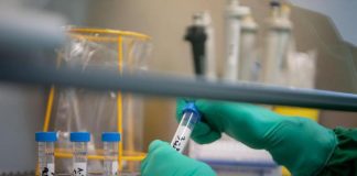 Da staminali pluripotenti speranza per diabete e futuro ‘insulina free’