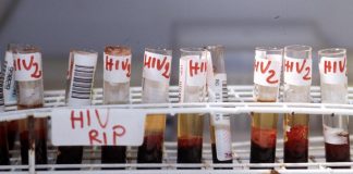 Hiv, Di Perri: “Terapia a 3 farmaci efficace e tollerata a lungo termine”