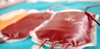 Trasfusione di sangue artificiale nei pazienti, prima volta al mondo