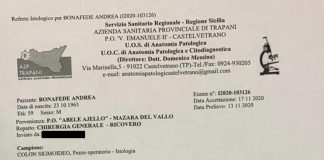Boss Messina Denaro affetto da tumore, nel 2020 la diagnosi