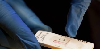 Crisanti, Zaia e caso tamponi rapidi in Veneto: cosa dicono i virologi