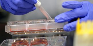 Malattia di Crohn, ok Ema a terapia orale ‘once a day’