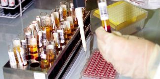 Emoglobinuria parossistica notturna per 350 italiani, come riconoscerla e curarla