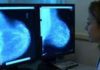 Screening tumore al seno, da settembre in Lombardia prenotazioni dal sistema “prenota salute”