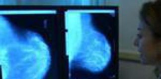 Screening tumore al seno, da settembre in Lombardia prenotazioni dal sistema “prenota salute”