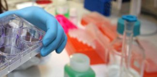 Tumori, da Aifa ok a rimborsabilità farmaco per amiloidosi da catene leggere