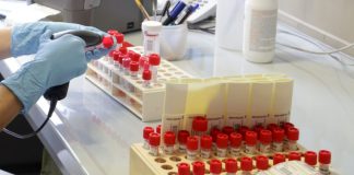 Malattie sessualmente trasmissibili +30% nella fase post Covid