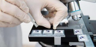 Malattie neurodegenerative, arriva dispositivo nanotech tutto made in Italy