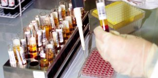 Ok Aifa a terapia first-in-class contro tumore sangue raro e aggressivo