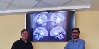 Ipertensione e demenza, studio individua strutture cerebrali danneggiate