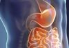 Malattia di Crohn, approvazione europea per il primo Jak inibitore