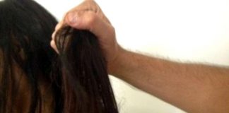 Alopecia per 4 mln donne, dermatologi in prima linea con terapie innovative