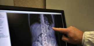 Affetto da demenza senile ingerisce involucro con cocaina e muore