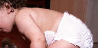 Esperti, ‘Sos pannolini in estate, con caldo e mare raddoppiano dermatiti’