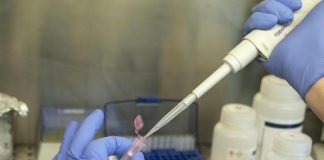 Screening neonatale esteso all’atrofia muscolare spinale