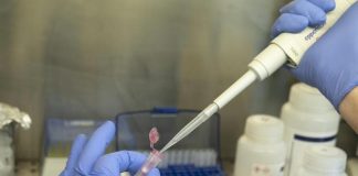 Aids, infettivologo Gori: “Prep non solo farmaco ma strategia anti-virus”