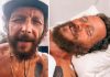 Incidente per Jovanotti, femore rotto e frattura alla clavicola