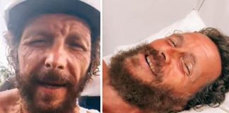 Incidente per Jovanotti, femore rotto e frattura alla clavicola